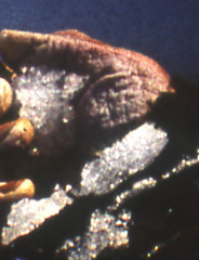 Detail of a frozen body