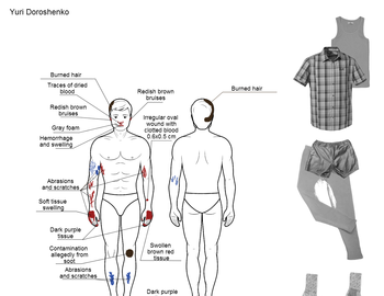 Injuries, clothing and belongings to Dyatlov group