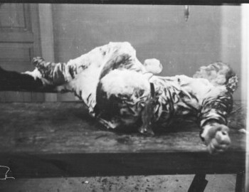 Rustem Slobodin in Ivdel morgue, 5 Mar 1959