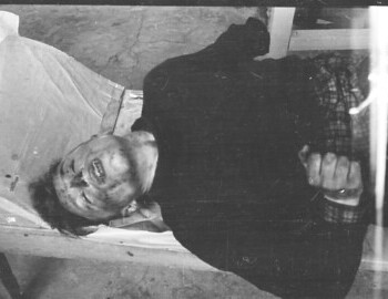 Slobodin in Ivdel morgue March 8, 1959