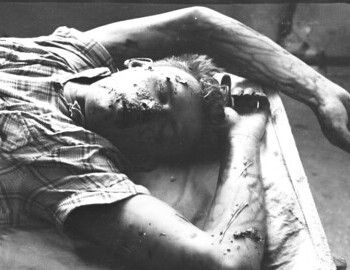Yuri Doroshenko in Ivdel morgue, 4 Mar 1959