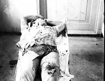 Yuri Doroshenko in Ivdel morgue, 4 Mar 1959