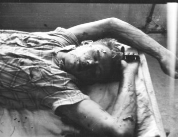 Yuri Doroshenko in Ivdel morgue, 4 Mar 1959