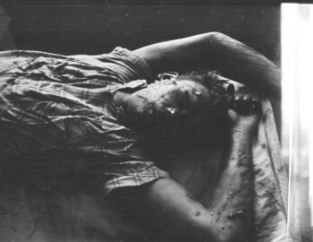 Yuri Doroshenko in Ivdel morgue, 4 Mar 1959