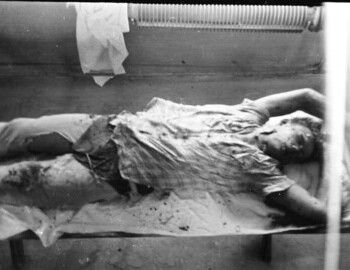 Yuri Doroshenko in Ivdel morgue, 4 Mar 1959
