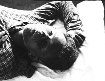 Yuri Krivonischenko in Ivdel morgue, 4 Mar 1959
