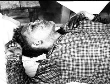 Yuri Krivonischenko in Ivdel morgue, 4 Mar 1959