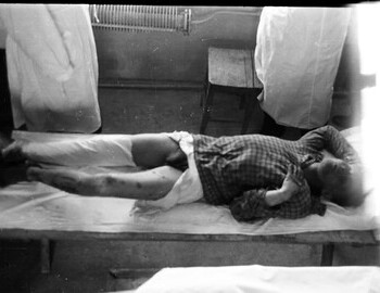 Yuri Krivonischenko in Ivdel morgue, 4 Mar 1959